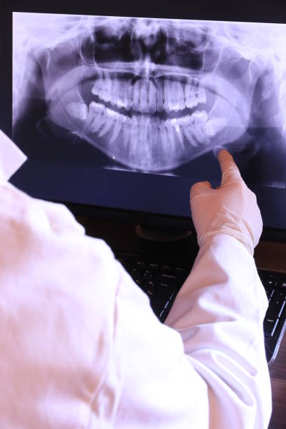 Best Broken or Chipped Tooth Repair in Ogden Dunes, IN